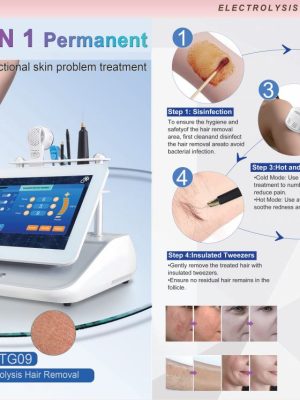 electrolysis hair romoval